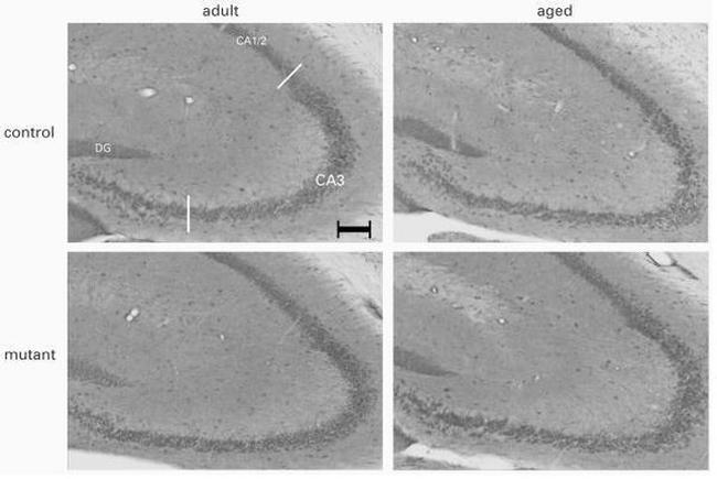 Phospho-NMDAR2B (Tyr1122) Antibody in Immunohistochemistry (IHC)