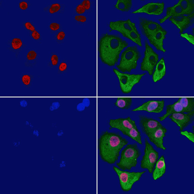 MTA3 Antibody in Immunocytochemistry (ICC/IF)