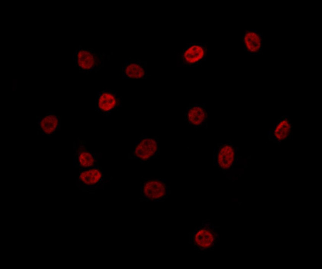 MTA3 Antibody in Immunocytochemistry (ICC/IF)