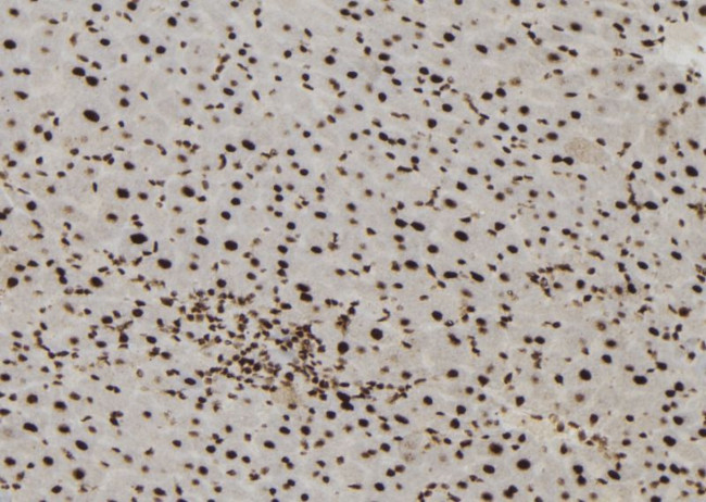 MTA3 Antibody in Immunohistochemistry (Paraffin) (IHC (P))