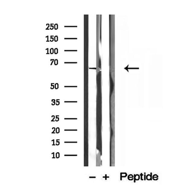 MTA3 Antibody in Western Blot (WB)