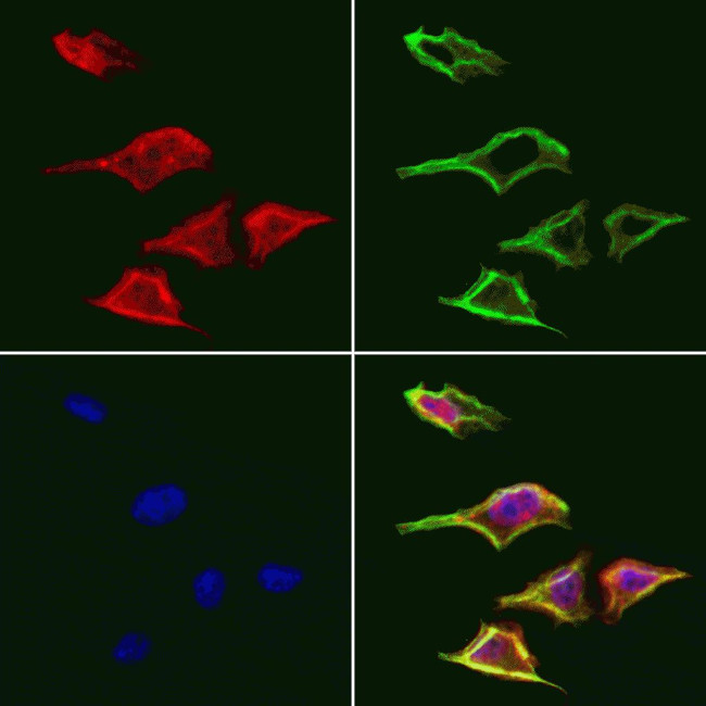 TELO2 Antibody in Immunocytochemistry (ICC/IF)