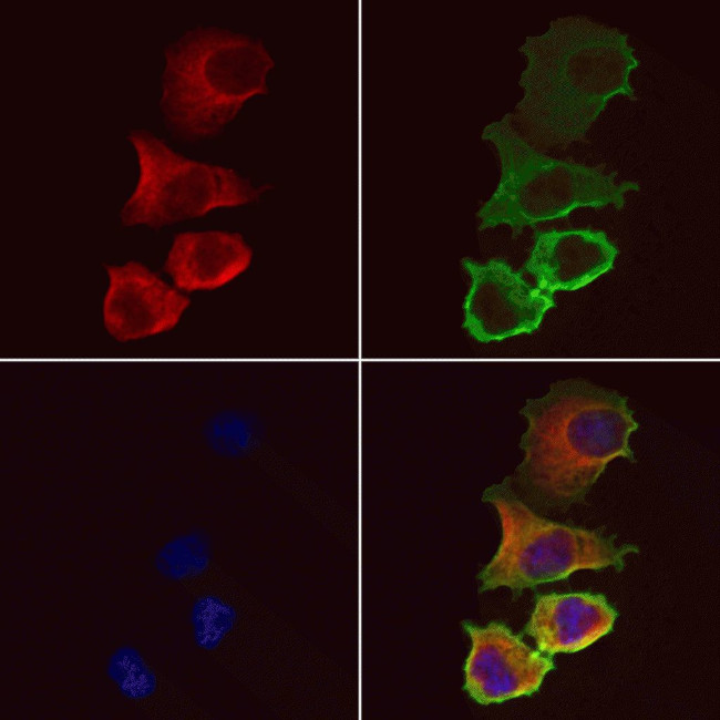 ACSL4 Antibody in Immunocytochemistry (ICC/IF)