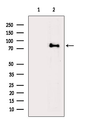 ACSL4 Antibody in Western Blot (WB)
