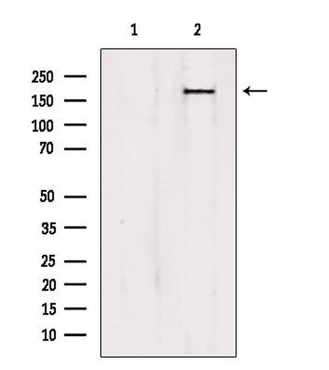 PTPN23 Antibody in Western Blot (WB)