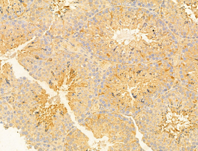 NAPRT1 Antibody in Immunohistochemistry (Paraffin) (IHC (P))