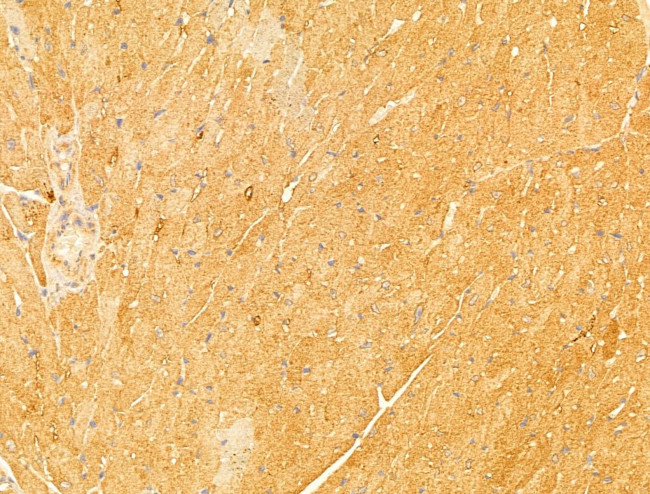 NAPRT1 Antibody in Immunohistochemistry (Paraffin) (IHC (P))