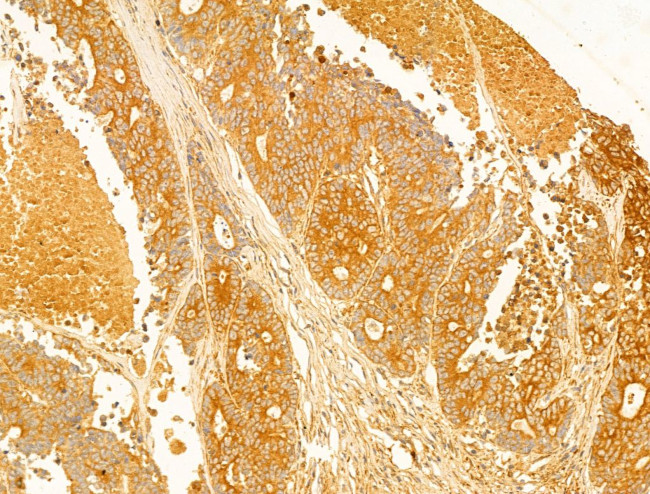 NAPRT1 Antibody in Immunohistochemistry (Paraffin) (IHC (P))