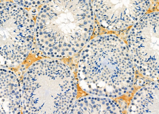 DNAJB3 Antibody in Immunohistochemistry (Paraffin) (IHC (P))