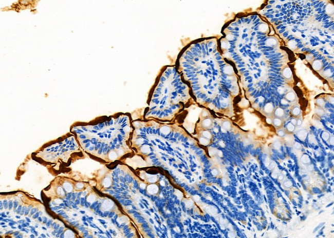 SLC10A2 Antibody in Immunohistochemistry (Paraffin) (IHC (P))