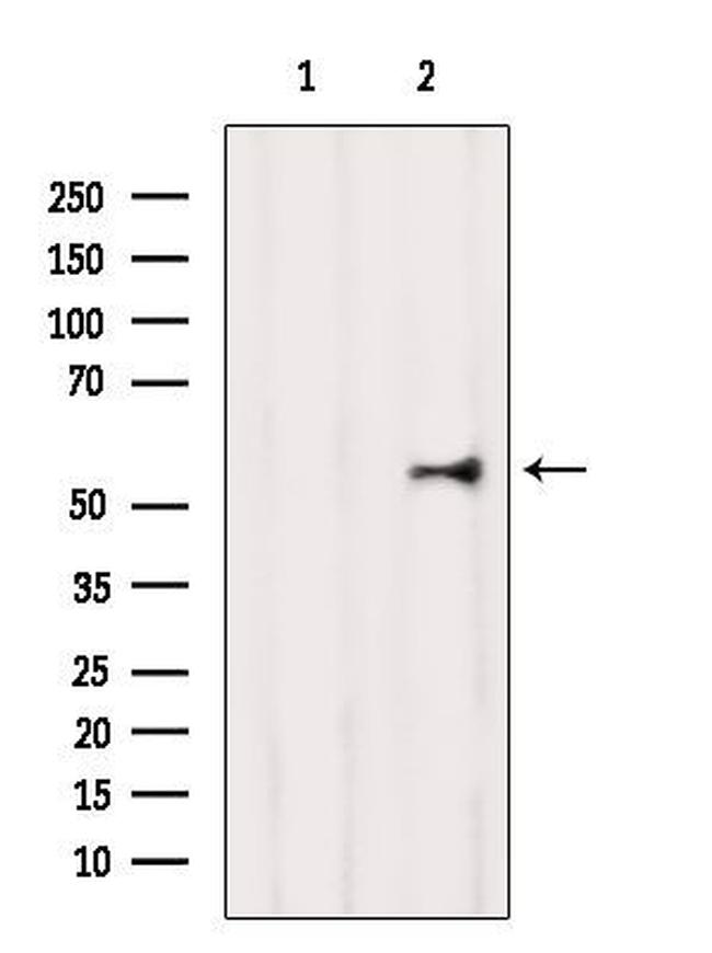 CAT1 Antibody in Western Blot (WB)