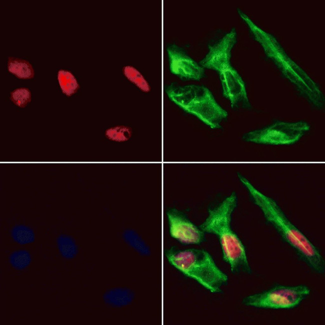 HDGFRP3 Antibody in Immunocytochemistry (ICC/IF)