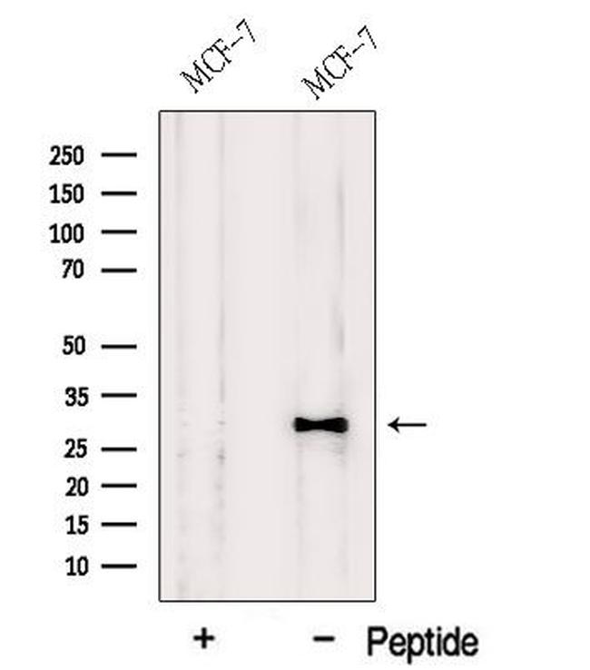 HDGFRP3 Antibody in Western Blot (WB)