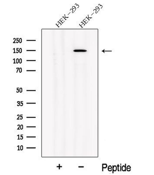 NPHP3 Antibody in Western Blot (WB)