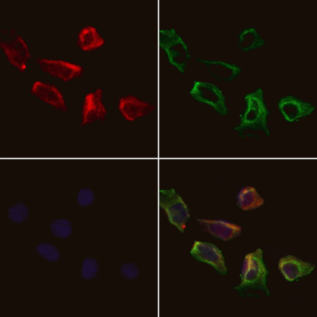 PPP3CB Antibody in Immunocytochemistry (ICC/IF)