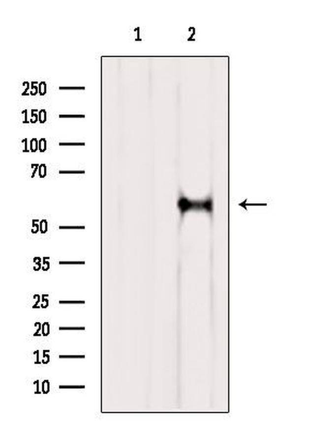 RIC8A Antibody in Western Blot (WB)