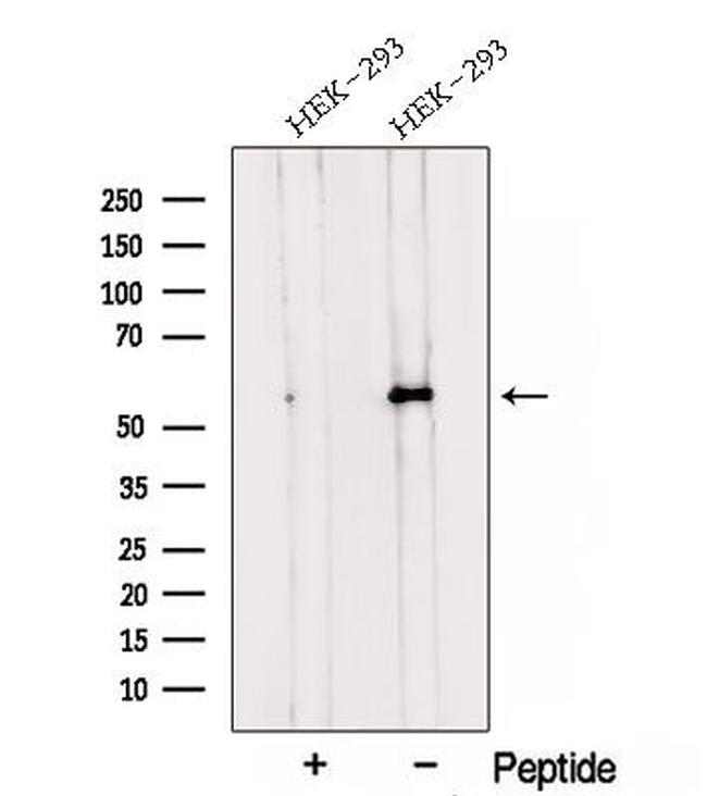 TMEM175 Antibody in Western Blot (WB)