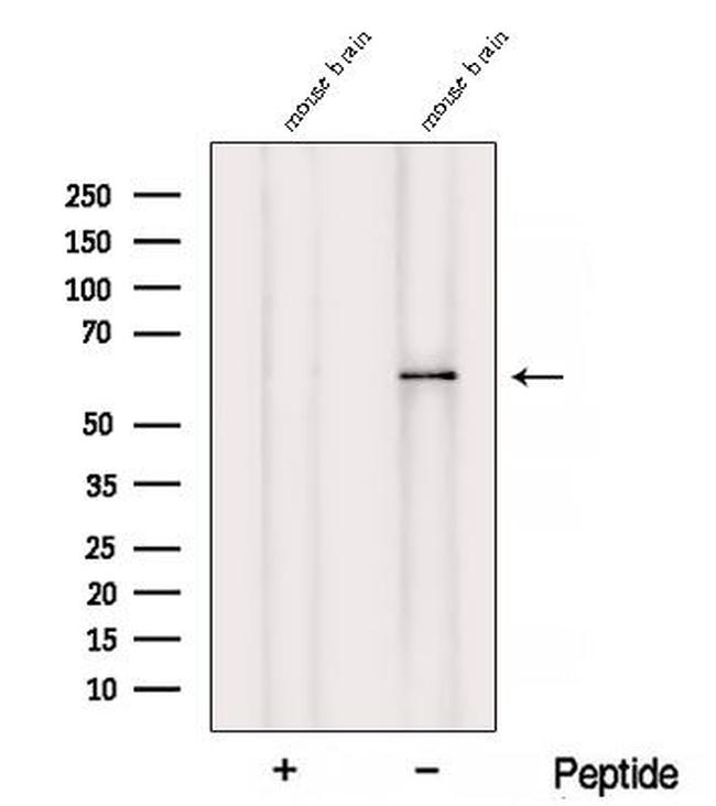 ZNF238 Antibody in Western Blot (WB)