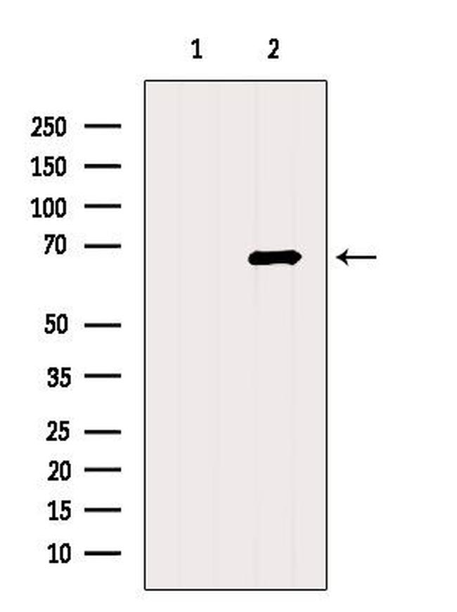 ACSM3 Antibody in Western Blot (WB)