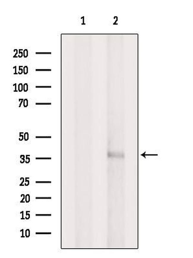 AIPL1 Antibody in Western Blot (WB)