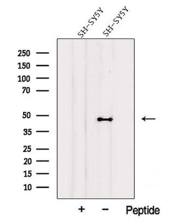 AIPL1 Antibody in Western Blot (WB)