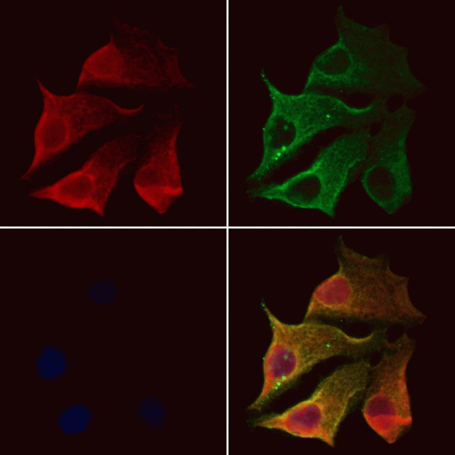 Clathrin Light Chain Antibody in Immunocytochemistry (ICC/IF)