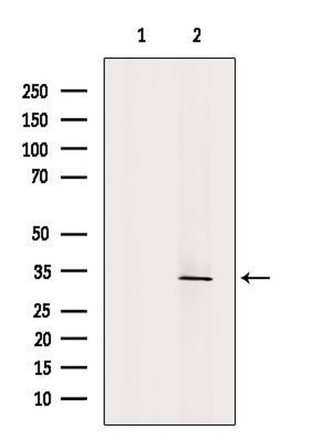 Clathrin Light Chain Antibody in Western Blot (WB)