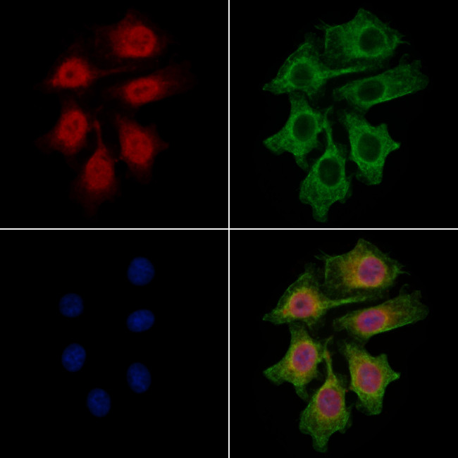 CNOT8 Antibody in Immunocytochemistry (ICC/IF)