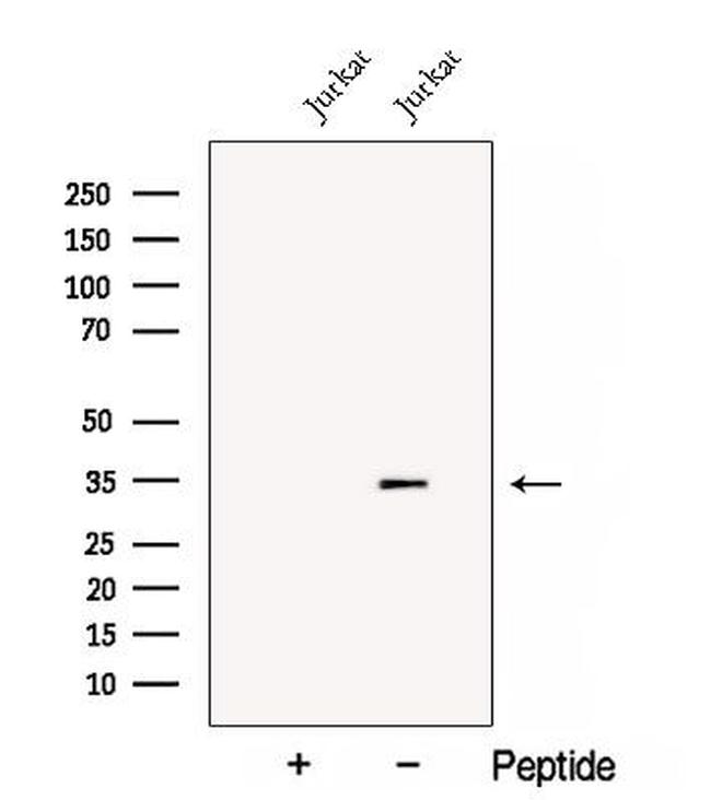 CNOT8 Antibody in Western Blot (WB)