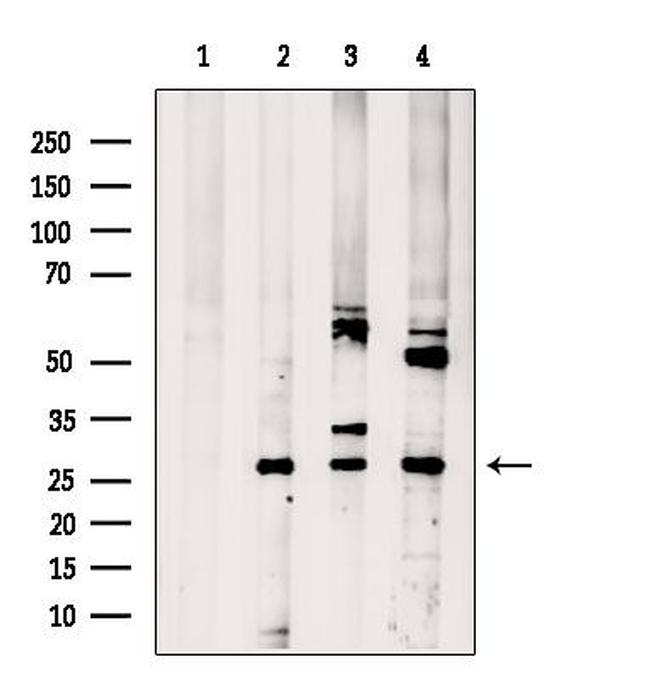 CNOT8 Antibody in Western Blot (WB)