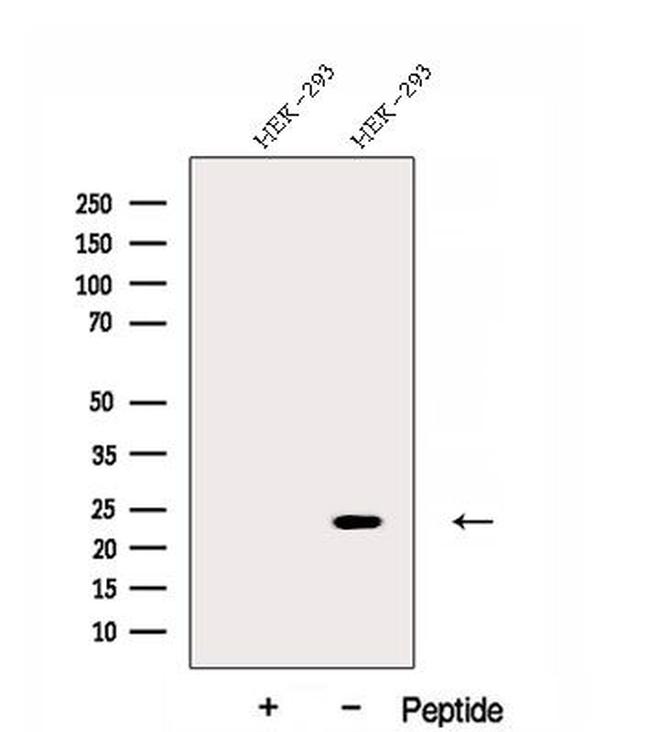 DNAJC12 Antibody in Western Blot (WB)