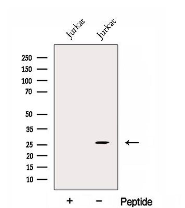 EXOSC4 Antibody in Western Blot (WB)