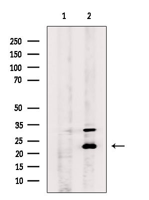 GINS3 Antibody in Western Blot (WB)