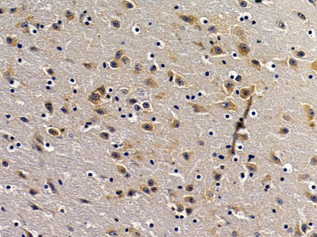 STCH Antibody in Immunohistochemistry (Paraffin) (IHC (P))