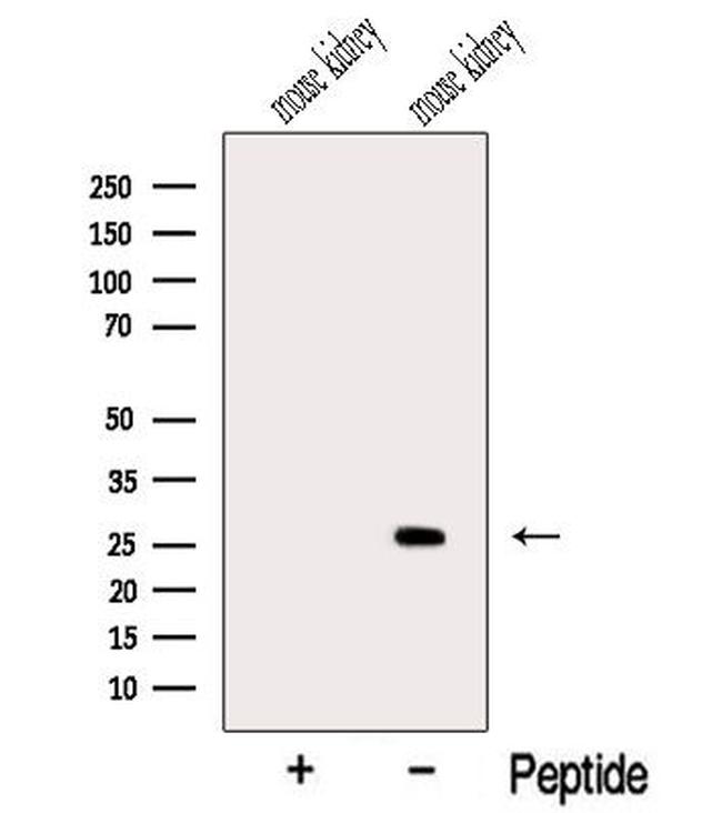 MSRA Antibody in Western Blot (WB)