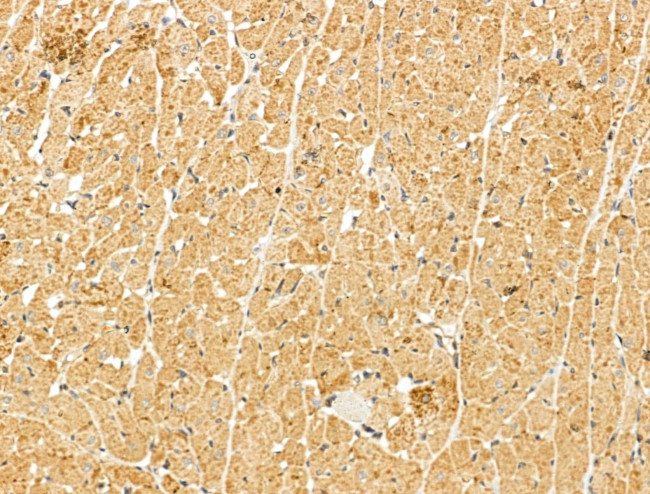 MYOF Antibody in Immunohistochemistry (Paraffin) (IHC (P))