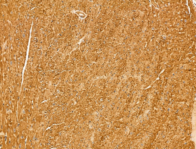 MYOF Antibody in Immunohistochemistry (Paraffin) (IHC (P))