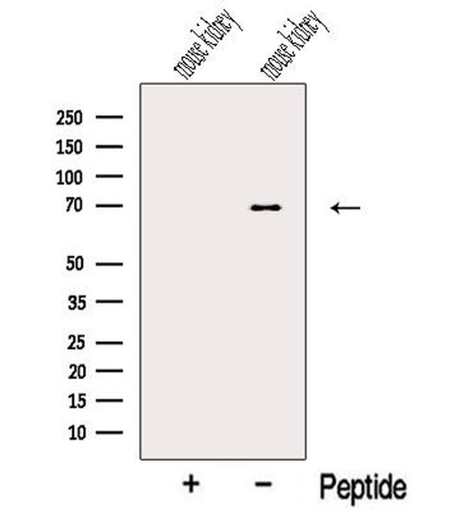 NPLOC4 Antibody in Western Blot (WB)