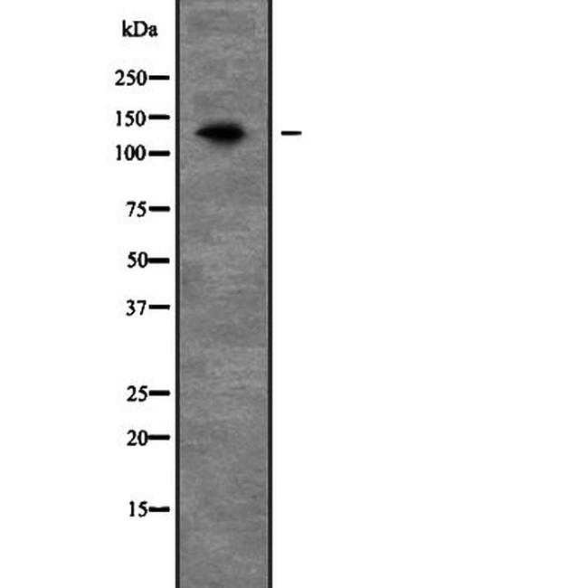 PEX1 Antibody in Western Blot (WB)