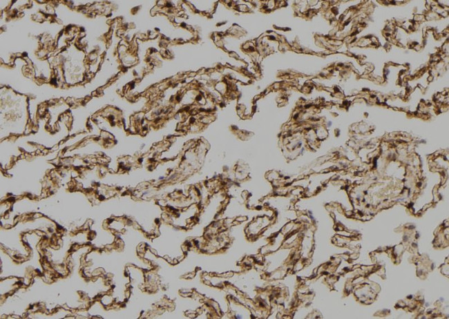 SH3BP2 Antibody in Immunohistochemistry (Paraffin) (IHC (P))