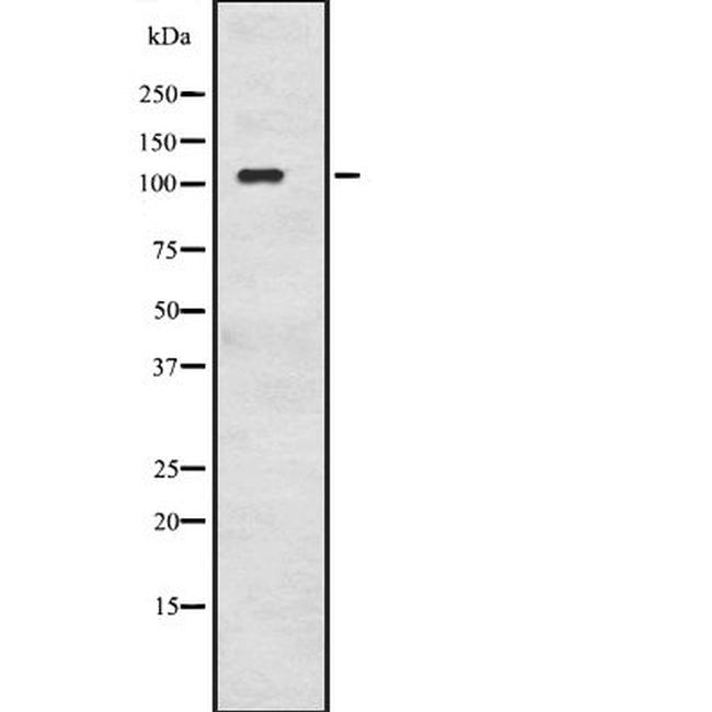 Adenylate Cyclase 8 Antibody in Western Blot (WB)
