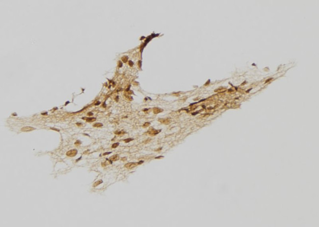 CENPI Antibody in Immunohistochemistry (Paraffin) (IHC (P))