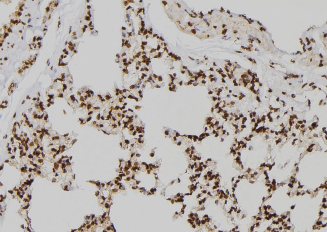 JMJD2D Antibody in Immunohistochemistry (Paraffin) (IHC (P))