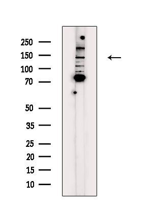 MYOCD Antibody in Western Blot (WB)