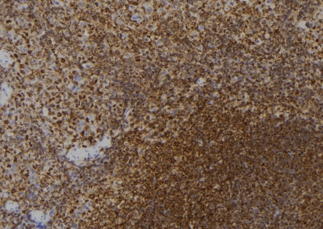 ZNF416 Antibody in Immunohistochemistry (Paraffin) (IHC (P))