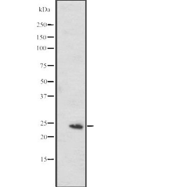 MED20 Antibody in Western Blot (WB)