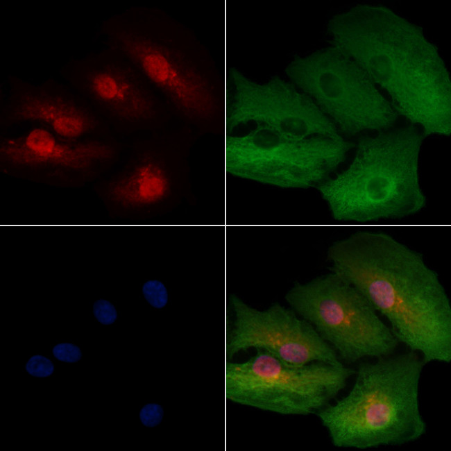 HSPB9 Antibody in Immunocytochemistry (ICC/IF)