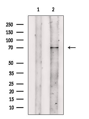 IFNAR2 Antibody in Western Blot (WB)