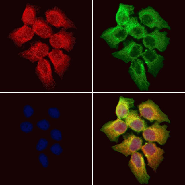 Cytokeratin 36 Antibody in Immunocytochemistry (ICC/IF)