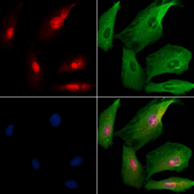 PROP1 Antibody in Immunocytochemistry (ICC/IF)